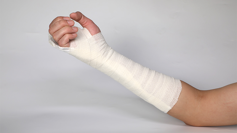 医用高分子夹板