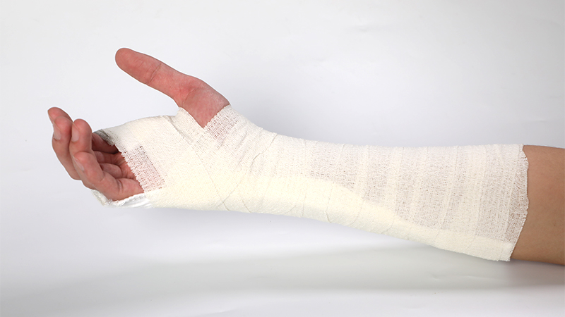 医用高分子夹板